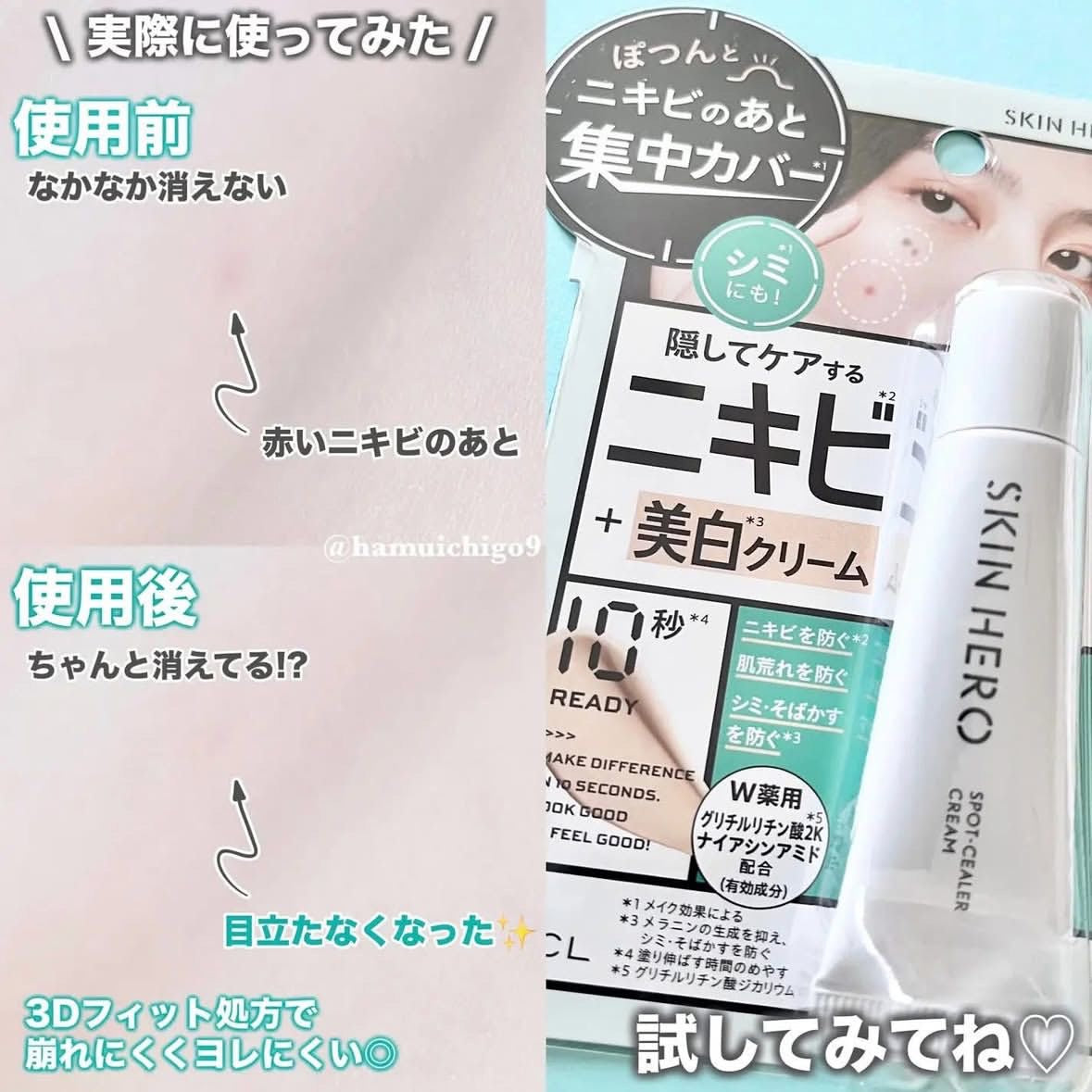 🇯🇵日本直送 2025年最新 SNS 熱門 Skin Hero 藥用祛斑遮瑕霜 10g