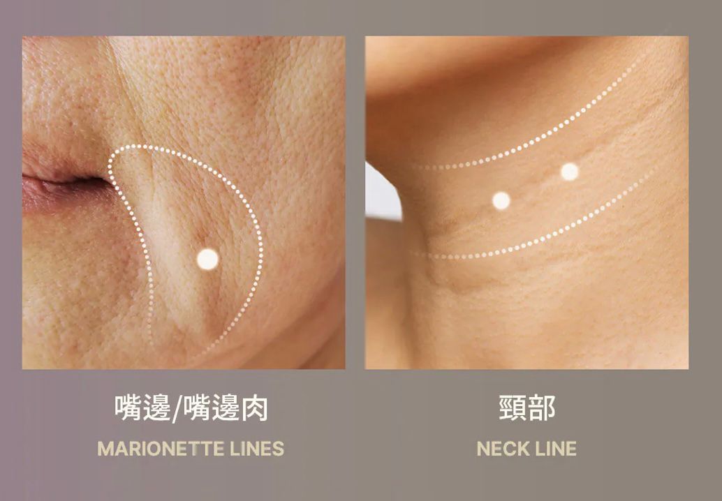 🇰🇷 韓國 Medicube DEEP VITA A Retinol Serum A醇緊緻彈力精華 30ml