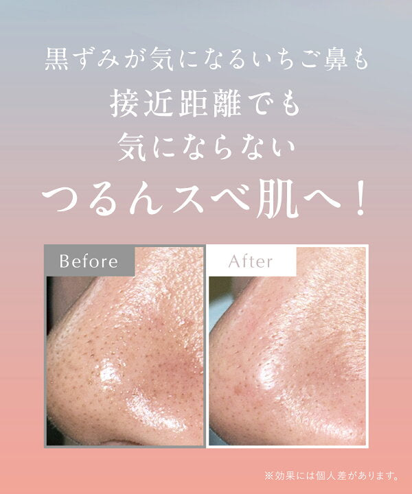 🇯🇵 日本直送 DROAS 泥系潔面 Rilakkuma 120g 限定版 🐻🫧