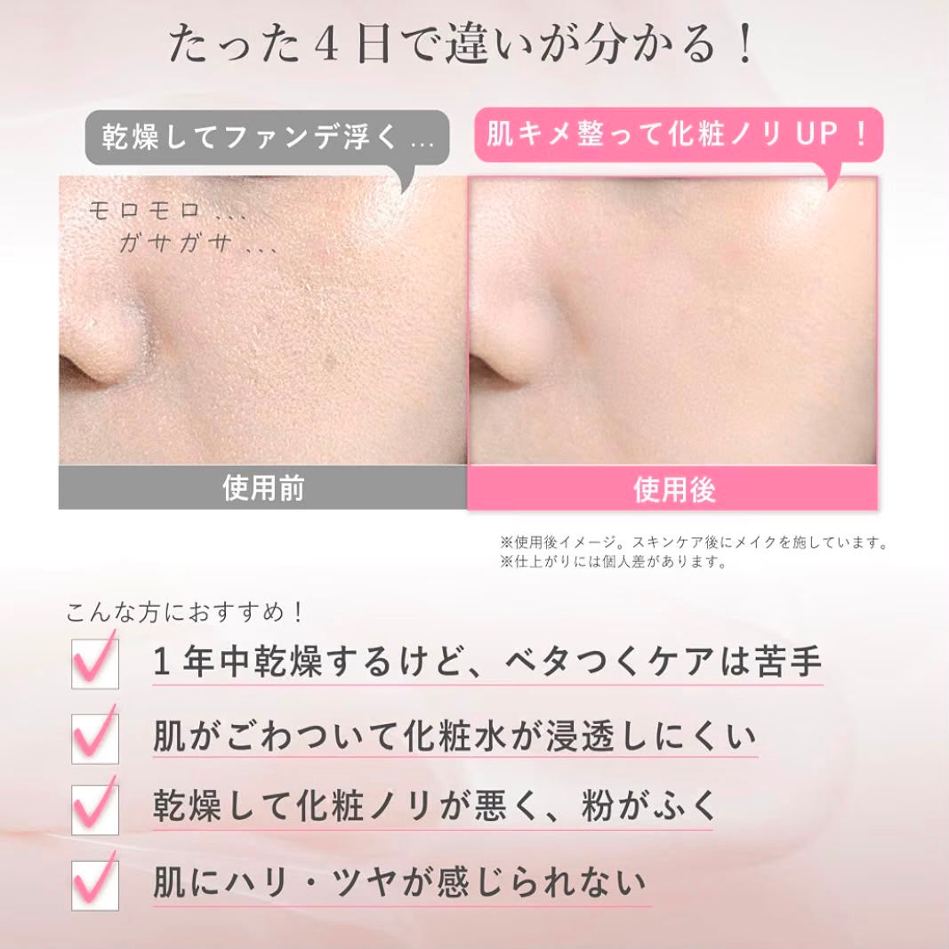 🇯🇵 日本直送 Rosemiu 脂質體導入精華