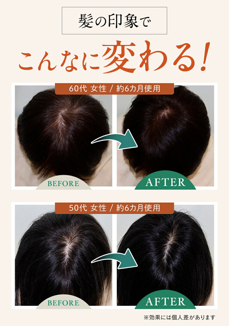 🇯🇵 日本直送 Rereje 女性專用育髮液 藥用 育髮精華 75ml