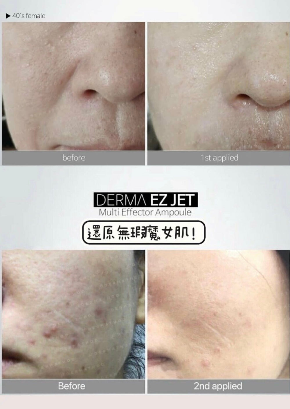 ✨Derma Ez Jet Witch Seal✨