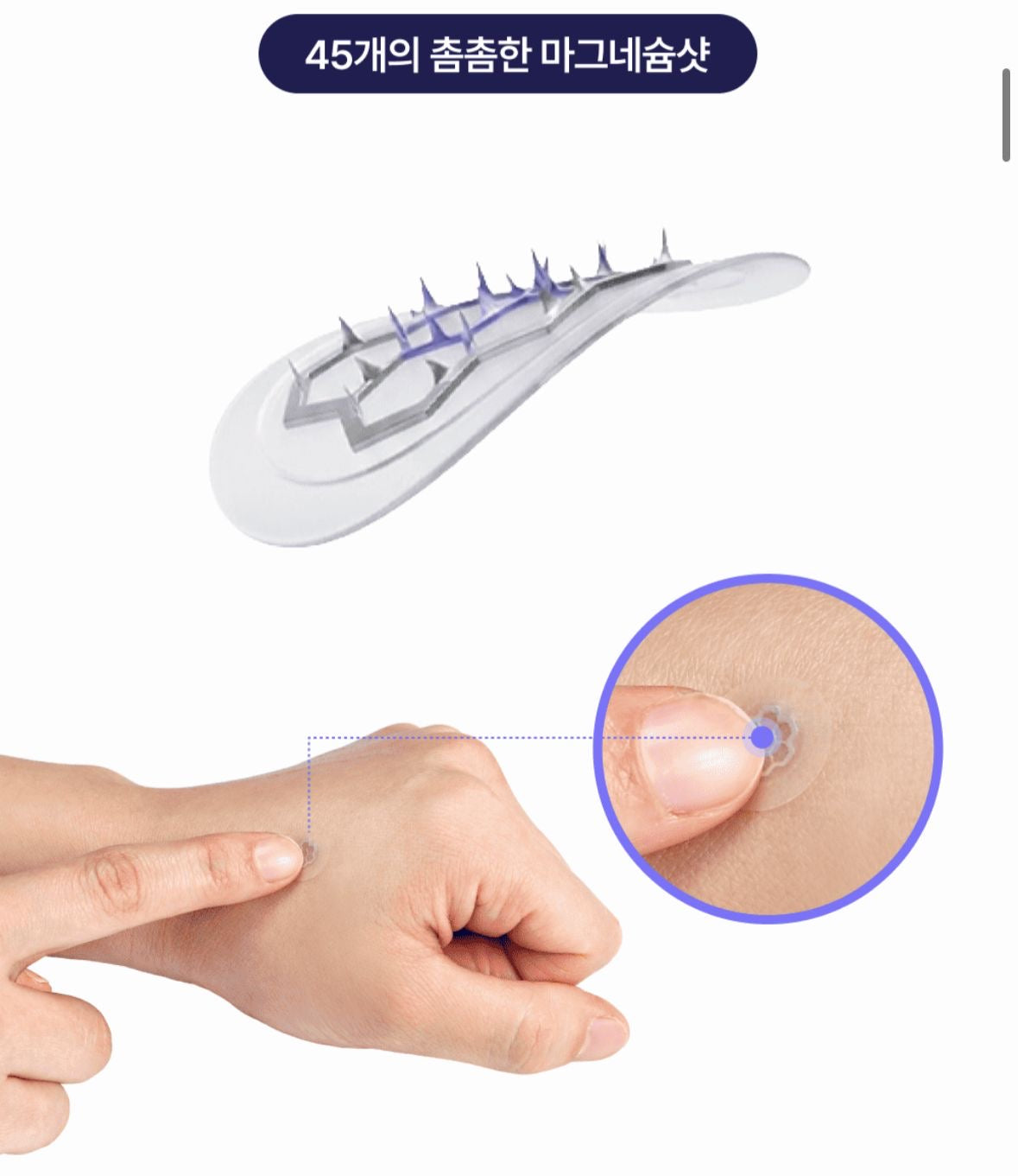 🇰🇷 Direct from Korea: Daewoong Pharmaceutical Easyderm Professional Acne Patch Series ✨