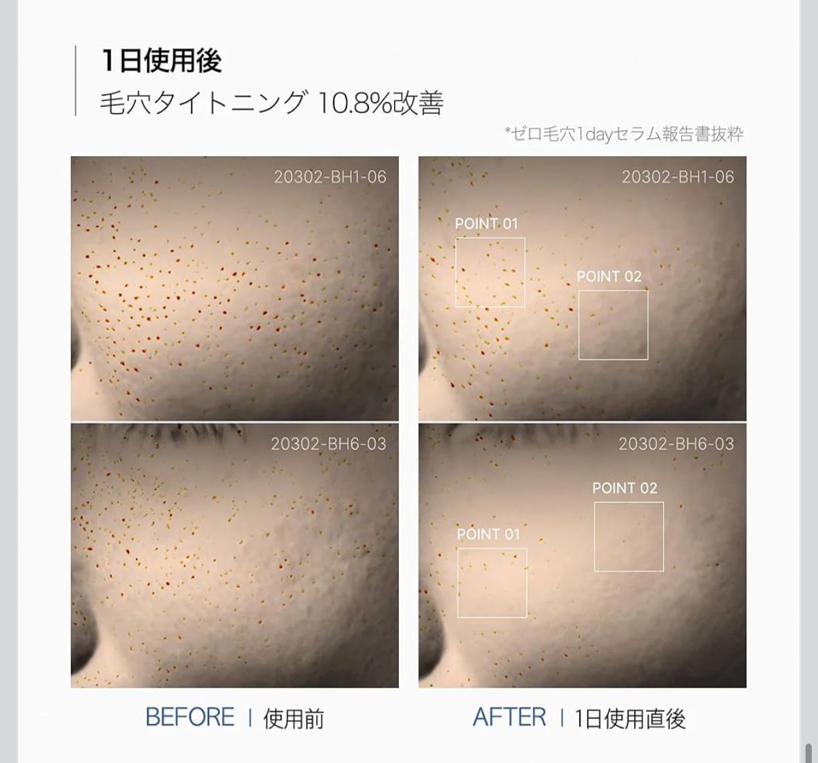 韓國 Medicube 毛孔急救精華 Zero Pore One Day Serum 30ml